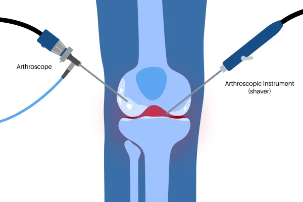 250036837_2bbf07f1-2bcd-4285-8392-19397cdd0880