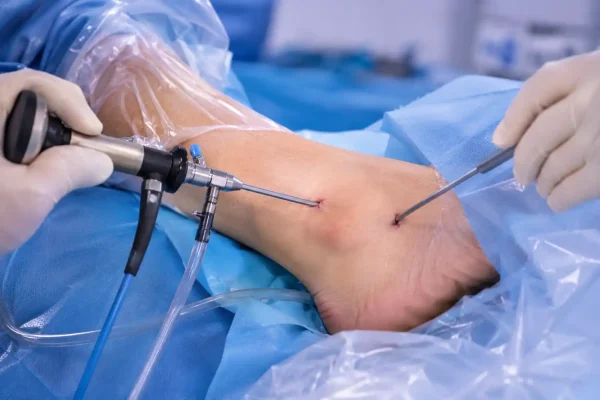 Ankle